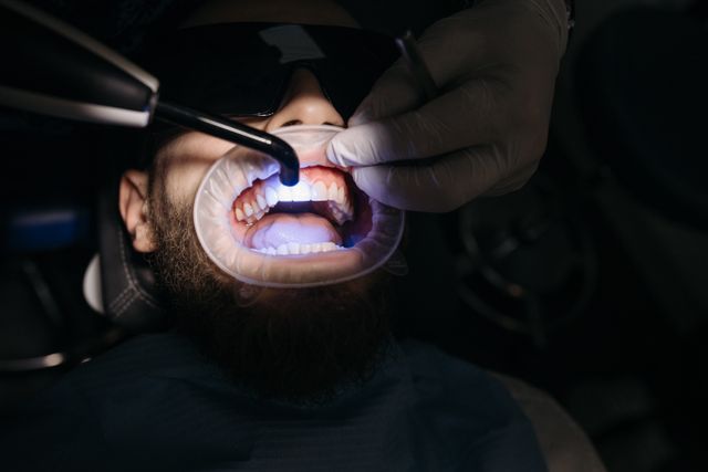 Caries dental: prevención y cuidado para una sonrisa saludable